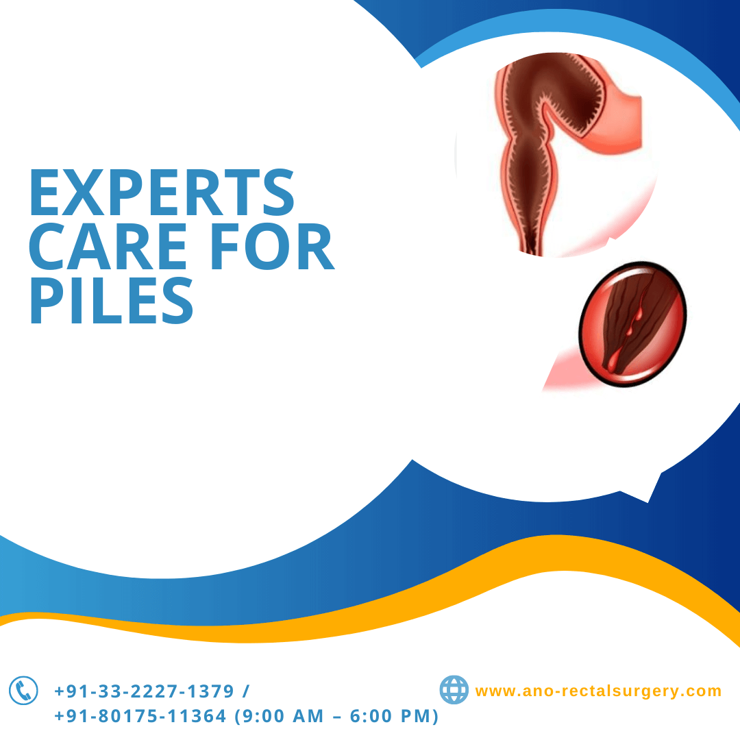 You are currently viewing Experts care for Piles, Fistula and Fissure: finding the Best Doctor In Kolkata