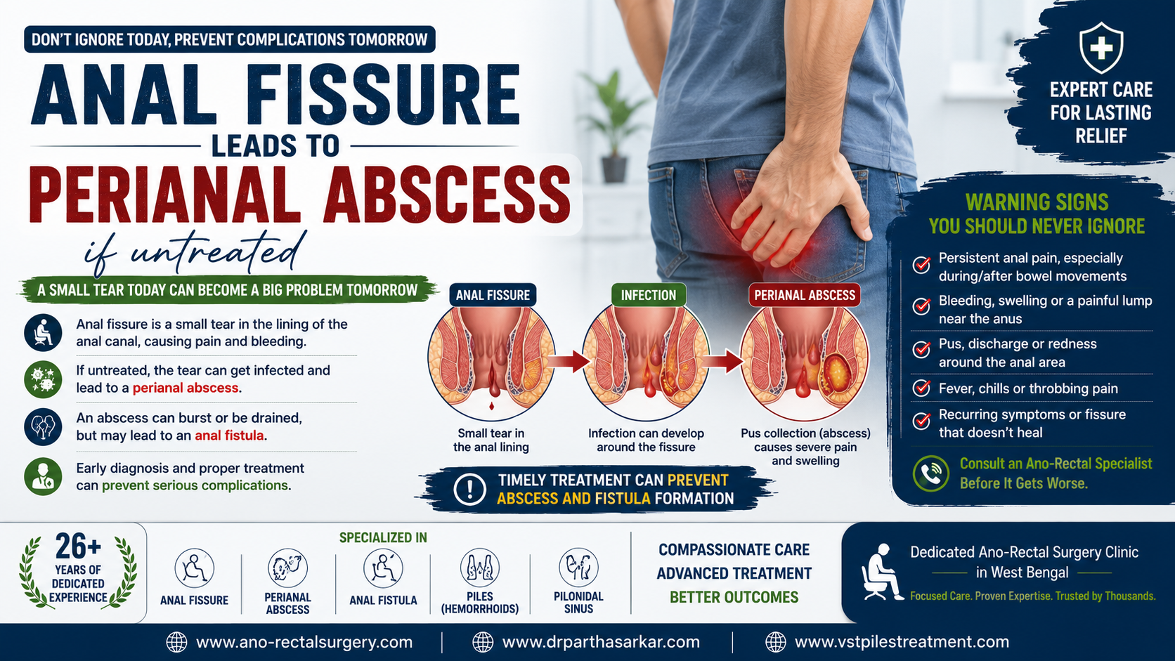 You are currently viewing Can an Untreated Anal Fissure Lead to a Perianal Abscess? Know the Warning Signs